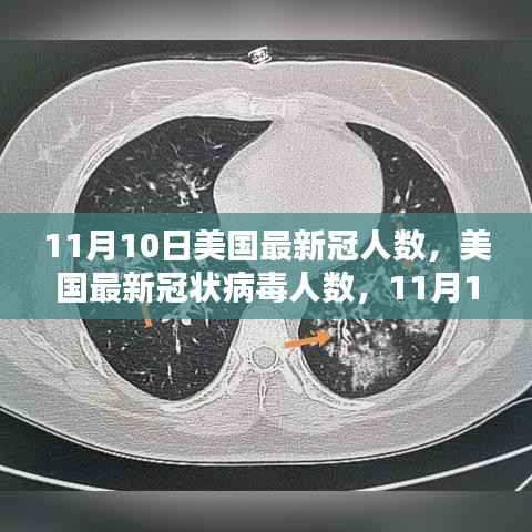 美国最新冠状病毒人数,11月10日的回顾与影响分析