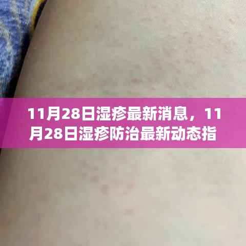 11月28日湿疹防治最新动态指南,全面管理湿疹,掌握应对技能