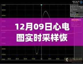心电图实时采样恢复技术重塑心跳监测新纪元,重塑健康守护体验的新纪元技术